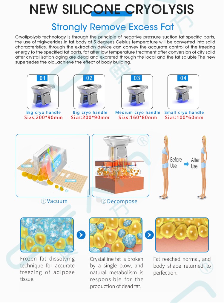 new Vertical cryo