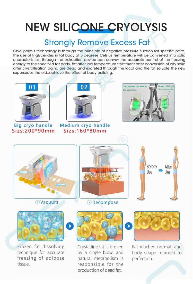 Portable Cryo