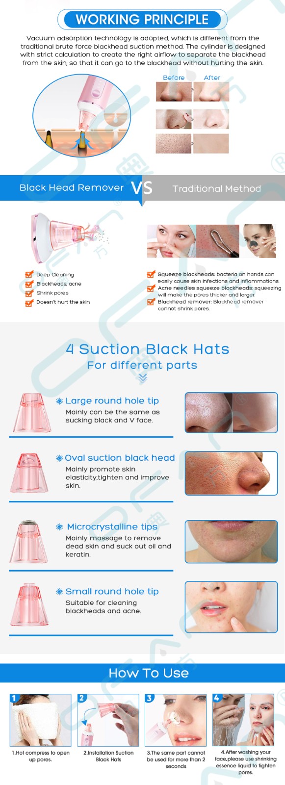 Black head remover